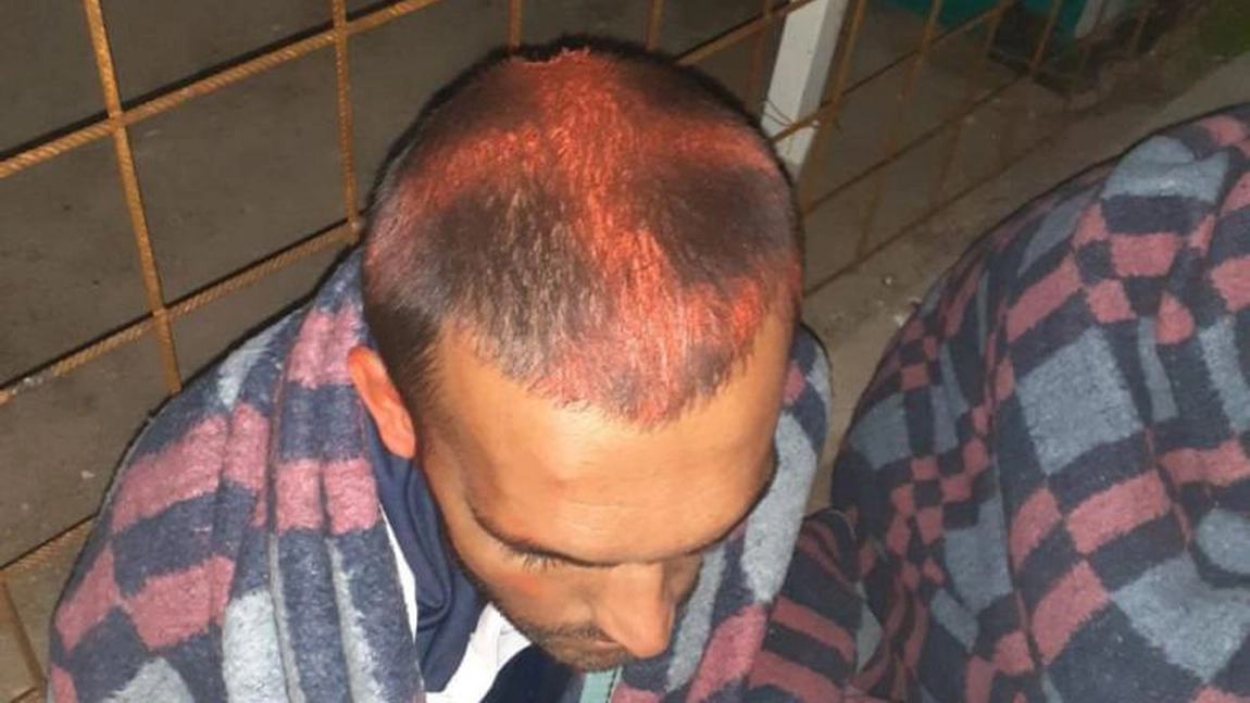 Poliţia croată, acuzată că marchează cu vopsea capetele refugiaţilor care solicită azil în ţară!