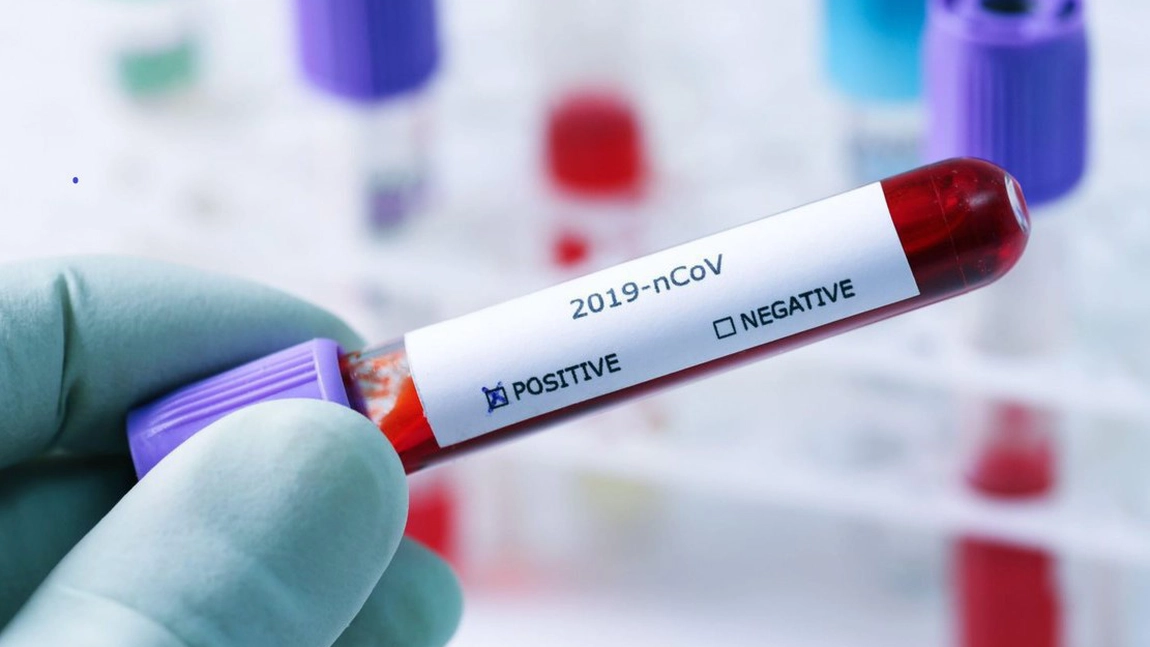 Alte două persoane au fost răpuse de coronavirus. Ce comorbidități aveau