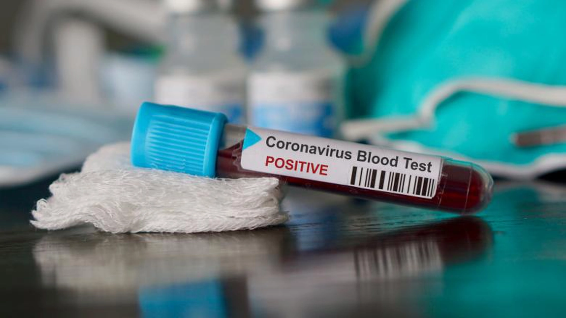 Un nou caz de COVID în şcolile din Iaşi! Nu a fost la Evaluarea Naţională