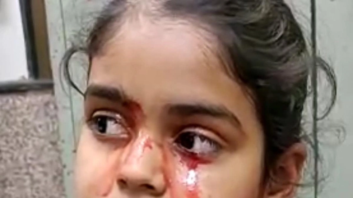 Caz medical extrem de rar: O fetita de 11 ani varsa lacrimi de sange