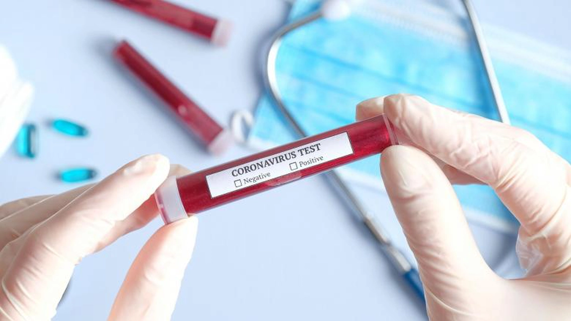Numărul infecțiilor din ultimele 24 de ore! Este in scădere
