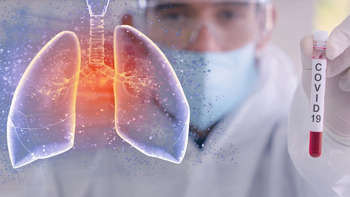 Medicament folosit pentru colesterol, tratament pentru coronavirus