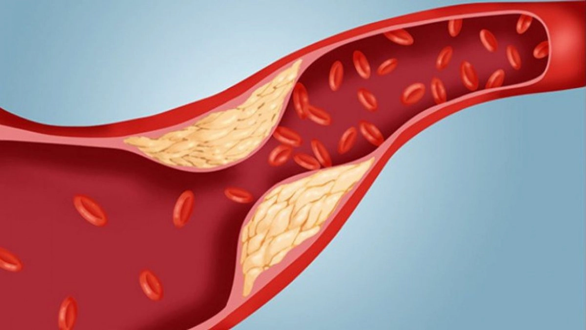 Reguli alimentare de respectat atunci cand tii o dieta anti-colesterol