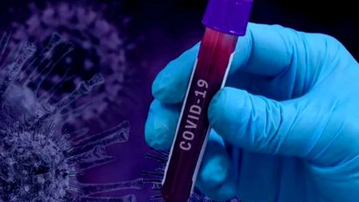 Avertismentul unui epidemiolog: „În luna august, am putea avea 800 de infecţii noi pe zi“
