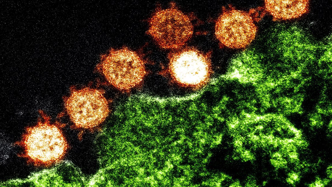 Furtunile de citokine impiedica un răspuns imun durabil la COVID-19