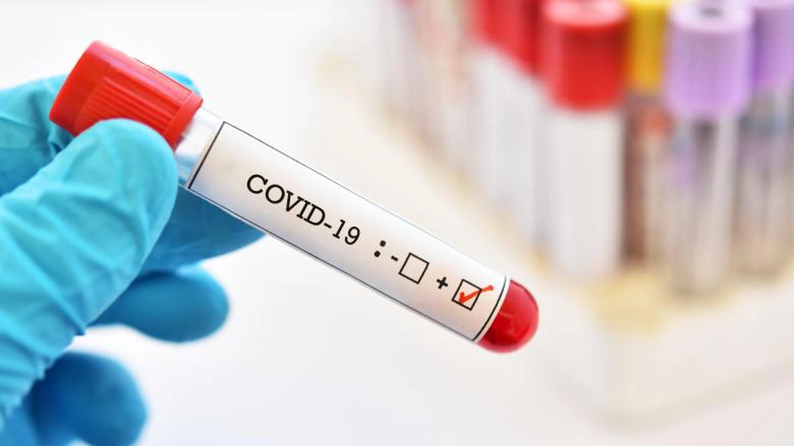 Încă un record al cazurilor de COVID-19 în ultimele 24 de ore în România