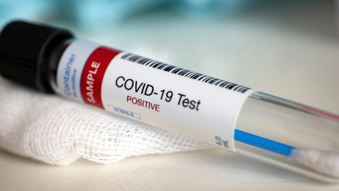 Numărul cazurilor noi de coronavirus au reînceput să crească. S-au înregistrat peste 1.200 de persoane infectate, în ultimele 24 de ore