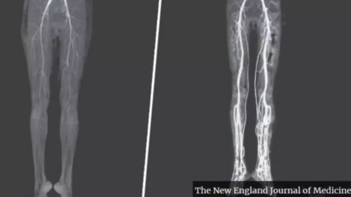 O tânără a primit un diagnostic dur de la medici după ce a început să aibă dureri insuportabile de picioare