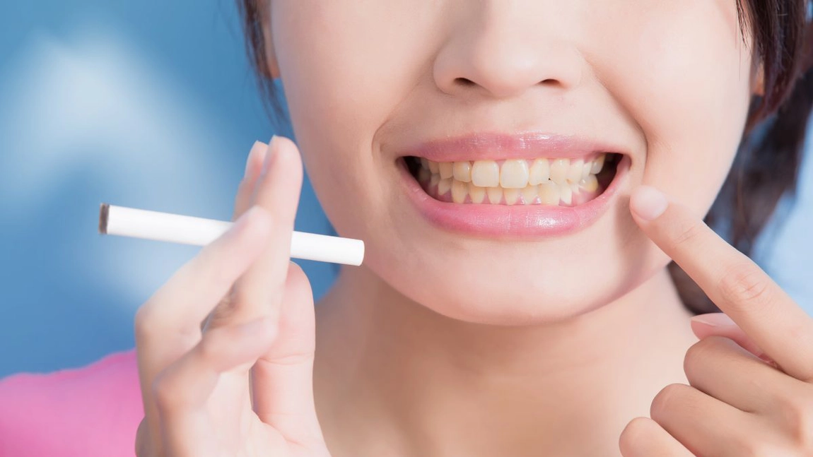 Recomandările specialiștilor în stomatologie: fumatul și implantul dentar