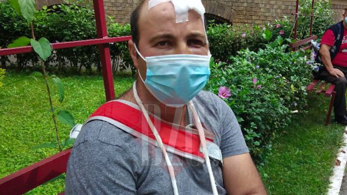 Bătut și furat de un consătean, care apoi l-a și postat pe Facebook. A ajuns la IML în stare deplorabilă