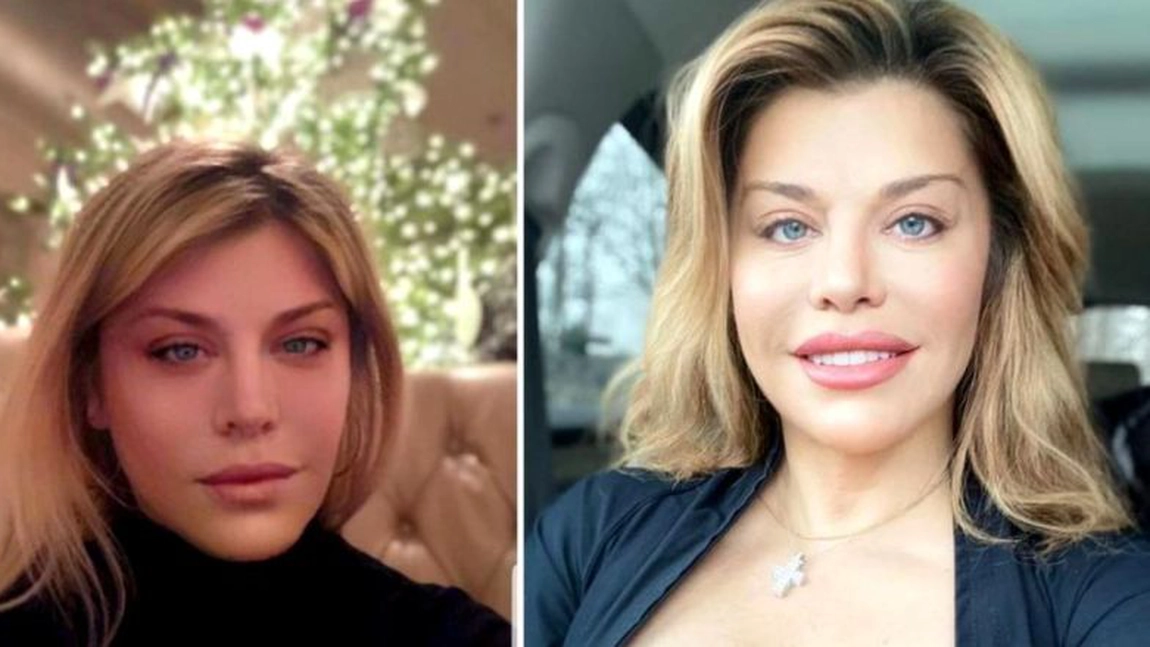 Loredana Groza este criticată de fani că s-ar fi operat la față. Cum răspunde vedeta