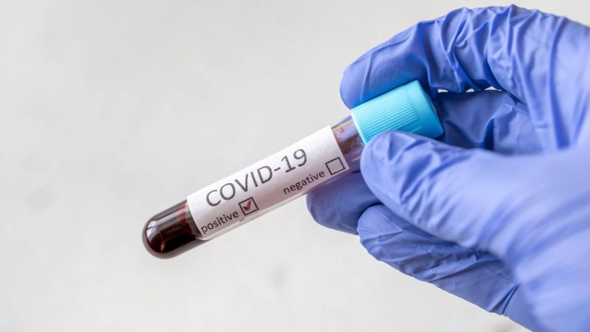 35 de ani de cercetari asupra infecțiilor cu coronavirus arată că imunitatea pe termen lung este puțin probabilă