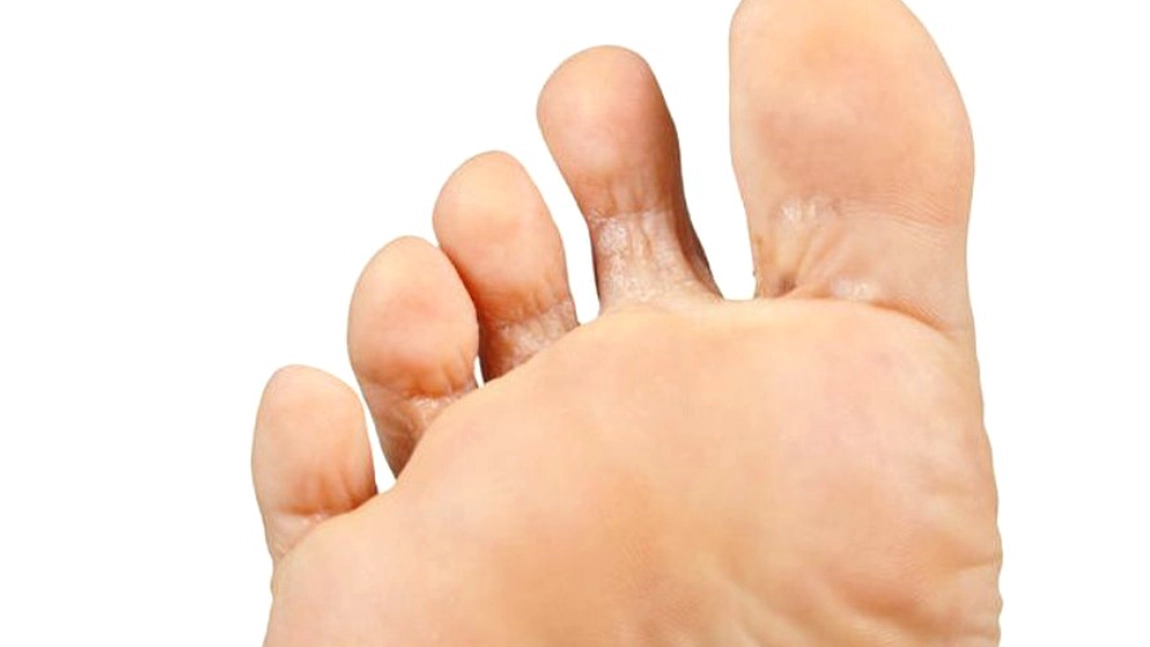 De ce apare ciuperca unghiilor și cum să scapi de ea?