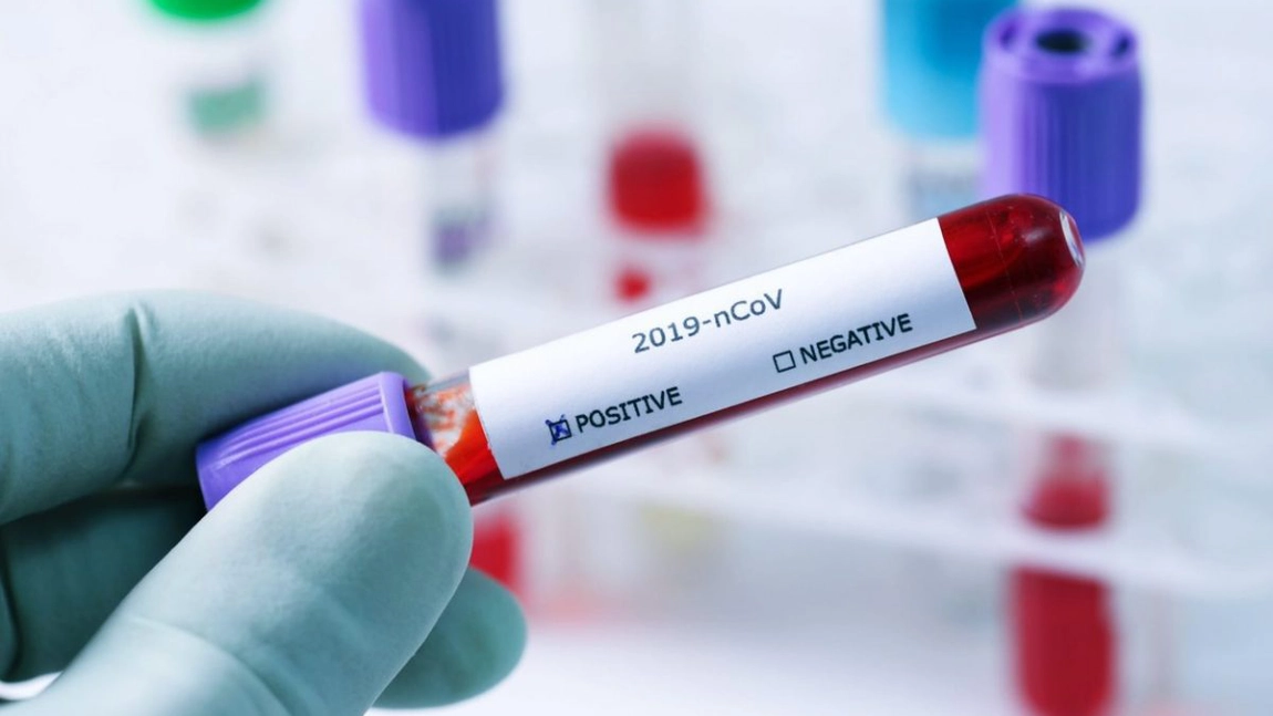 Reinfectarea cu COVID-19 este putin probabila timp de cel putin 6 luni