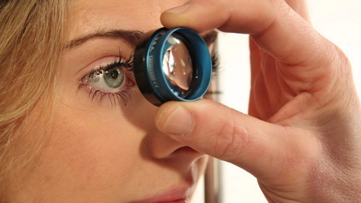 Nou mod de a trata glaucomul fără medicamente sau intervenții chirurgicale