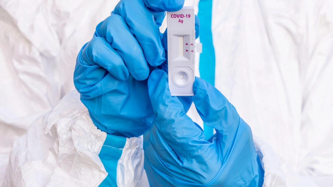 7.365 cazuri noi de persoane infectate cu SARS – CoV – 2 în ultimele 24 de ore
