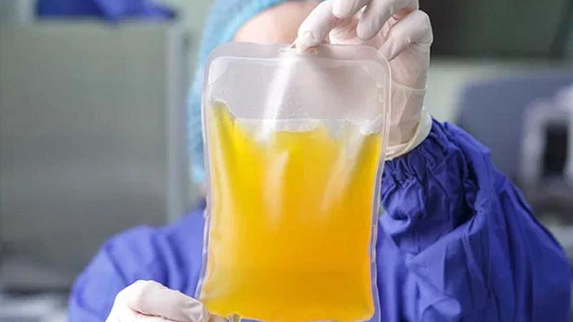 Răsturnare de situație! Plasma nu aduce niciun beneficiu pacienților cu forme grave de COVID-19 - STUDIU
