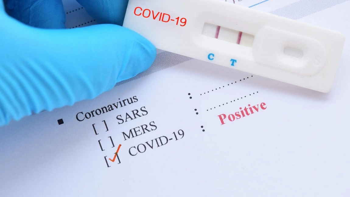 2.712 cazuri noi de persoane infectate cu noul coronavirus, înregistrate în ultimele 24 ore. Situația Covid-19 pe județe