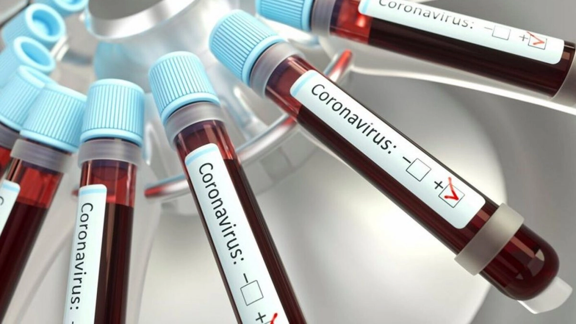Șase elevi, confirmați pozitiv cu noul coronavirus, în ultimele 24 ore, la Iași