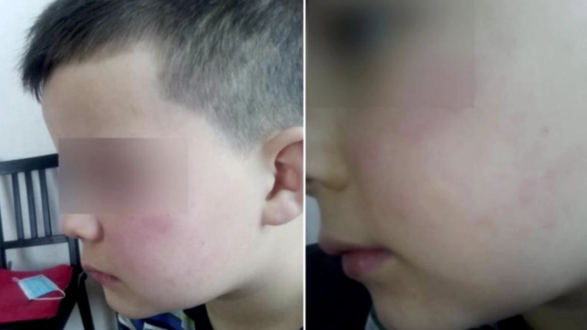 Băiețel de șapte ani, bătut de tatăl unei colege de școală. Copilul refuză să mai meargă la unitatea de învățământ