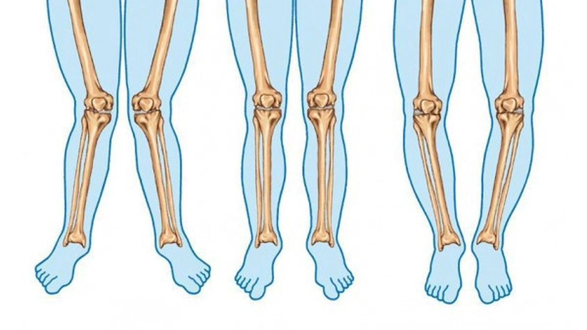 Gonartroză tratament naturist. Cum puteți trata osteoartrita genunchiului cu remedii naturiste