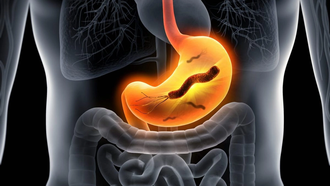 Leacuri din bătrâni pentru Helicobacter Pylori: Cum te ajută tratamentele naturiste să scapi de infecție