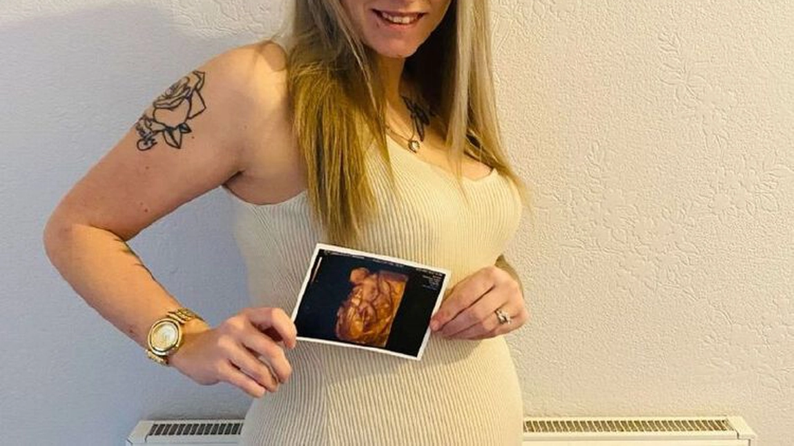 Ecografia 4D a unui bebeluș a ajuns virală. Ce a observat medicul