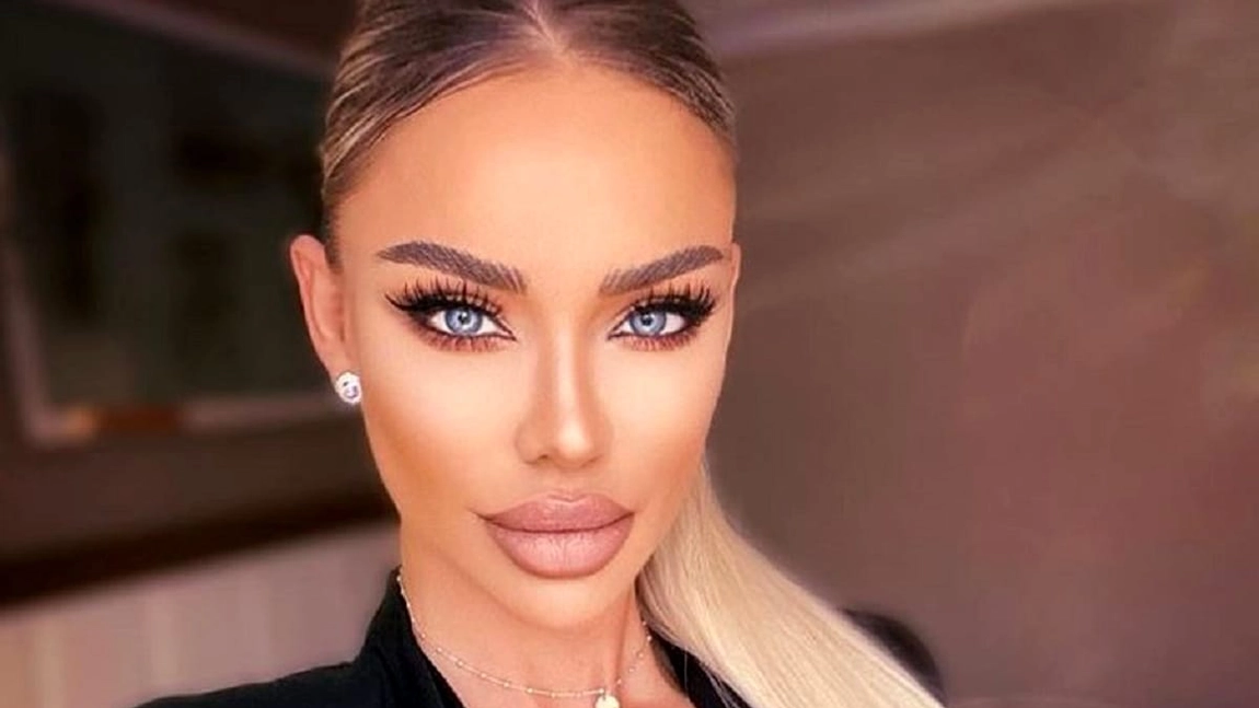 Ce a pățit Bianca Drăgușanu la ochi. A apărut așa la o petrecere mondenă