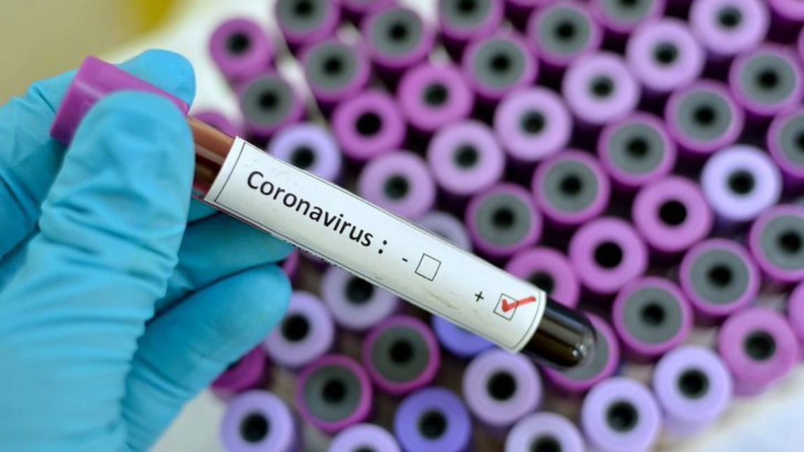65 cazuri noi de persoane infectate cu SARS – CoV – 2, în ultimele 24 de ore, în România
