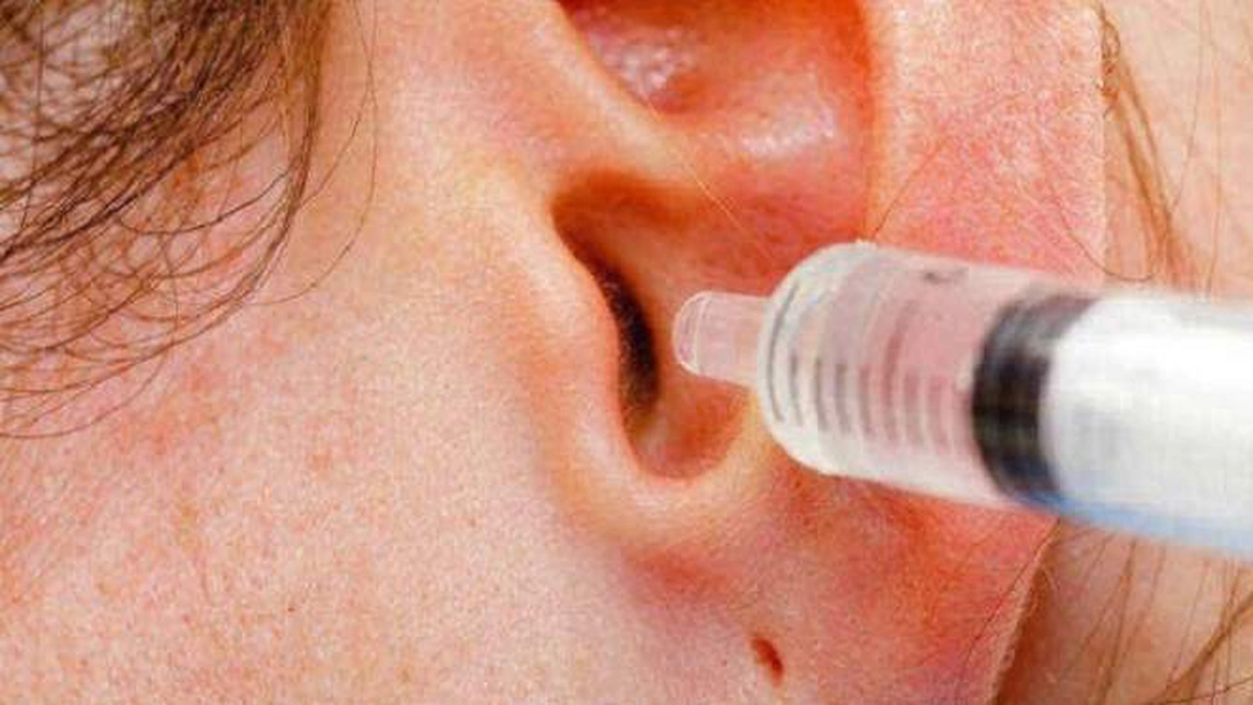 Cu ce se scoate dopul de ceară din ureche: Câteva soluții pe care le recomandă medicii de la ORL