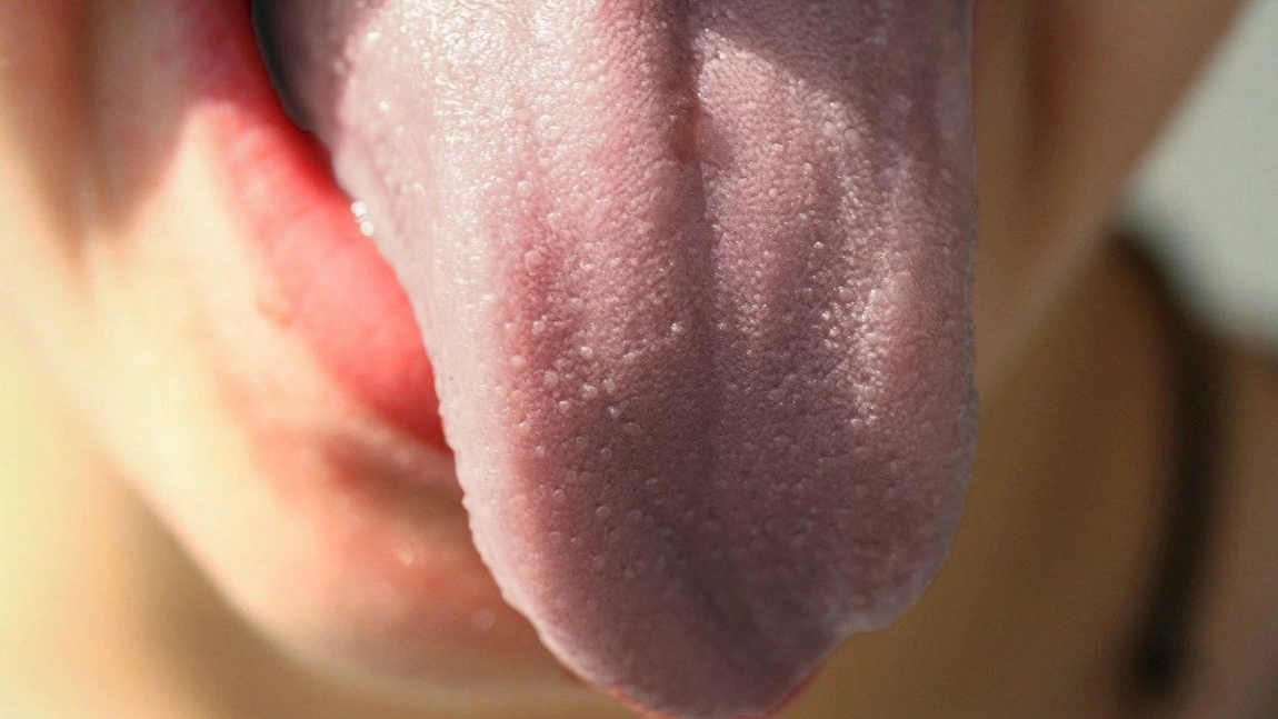 Papile gustative inflamate: Cum să scapi de această problemă sâcâitoare