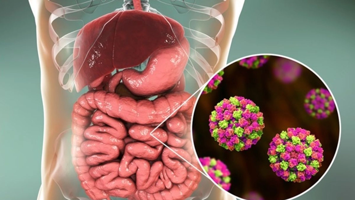 Noua epidemie de Norovirus în oraşul Râşnov. Circa 140 de persoane s-au prezentat la medic cu simptome