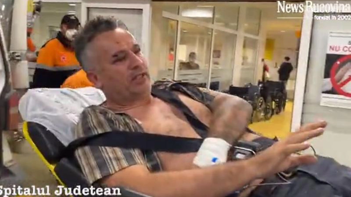 Unde este poliţia?! Doi jurnalişti au ajuns în stare gravă la spital după ce au fost bătuţi cu bâte şi topoare de mafia lemnelor - FOTO, VIDEO