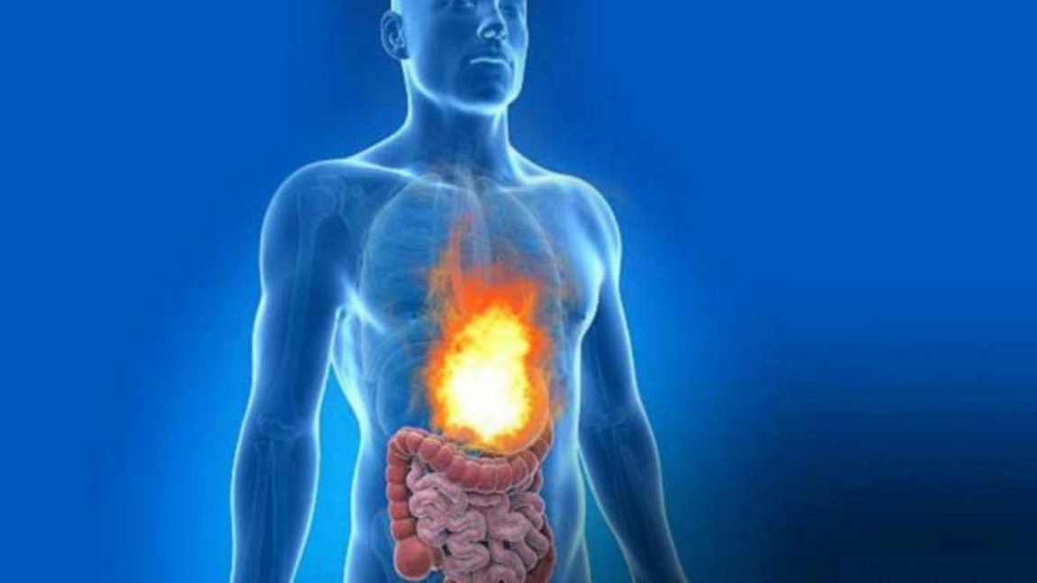Medicamente care scad aciditatea gastrică: Cum te pot ajuta antacidele