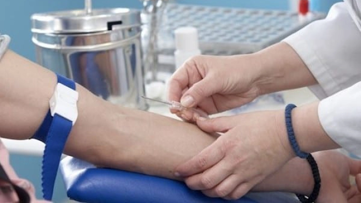 Simptome la hepatita C. Reguli de alimentație corectă