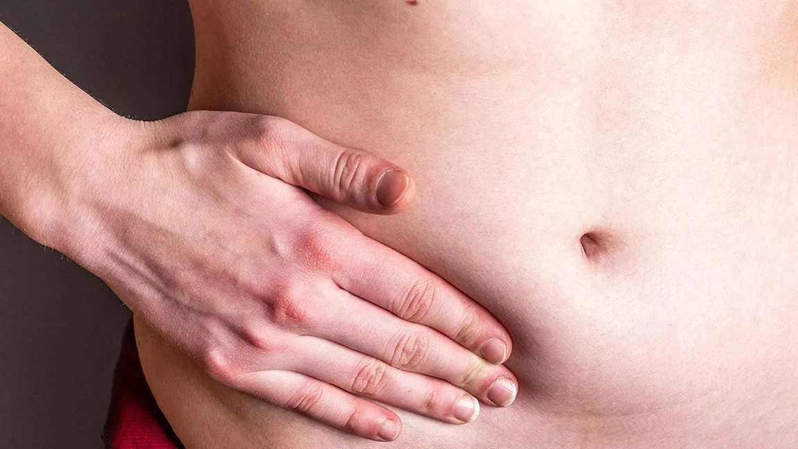 Hernia inghinală fară operație: Sfatul medicului și remedii naturiste
