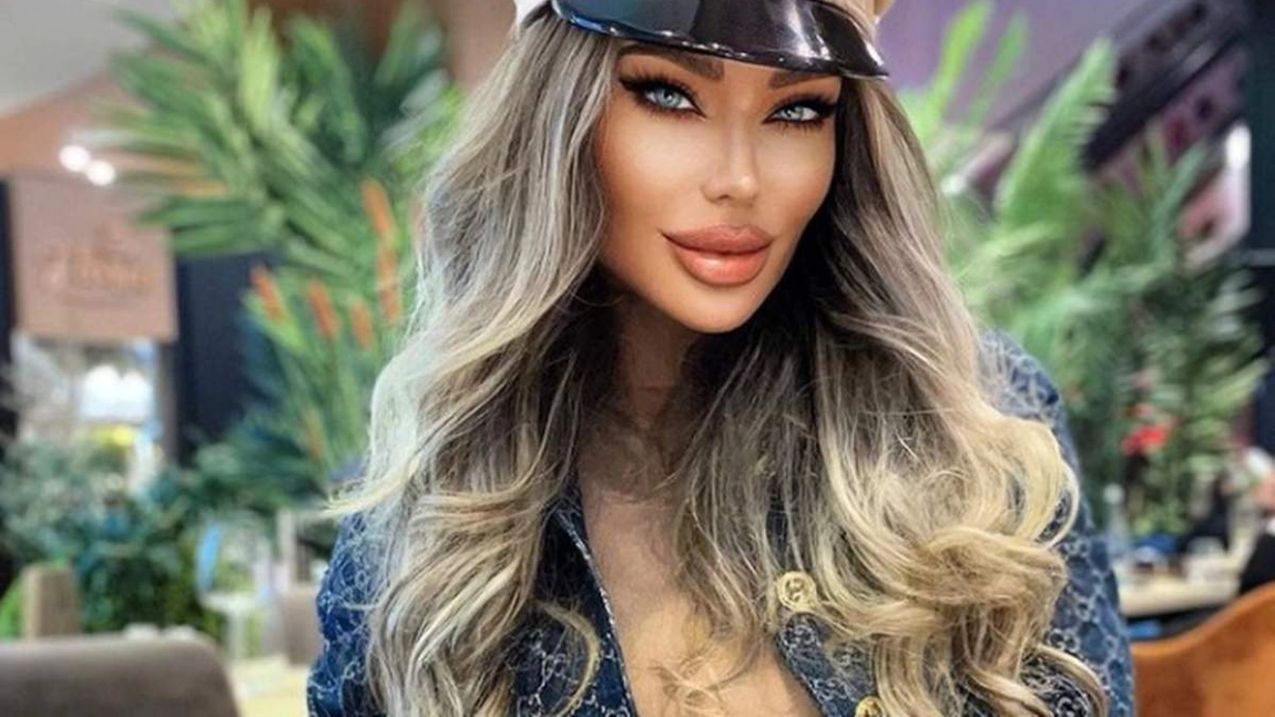 Bianca Drăgușanu, o nouă operație estetică. Diva a recurs la cantopexie - „ochi de pisică”