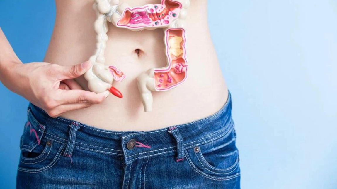 Rectocolita ulcerohemoragică (RCUH): Simptome și tratament biologic