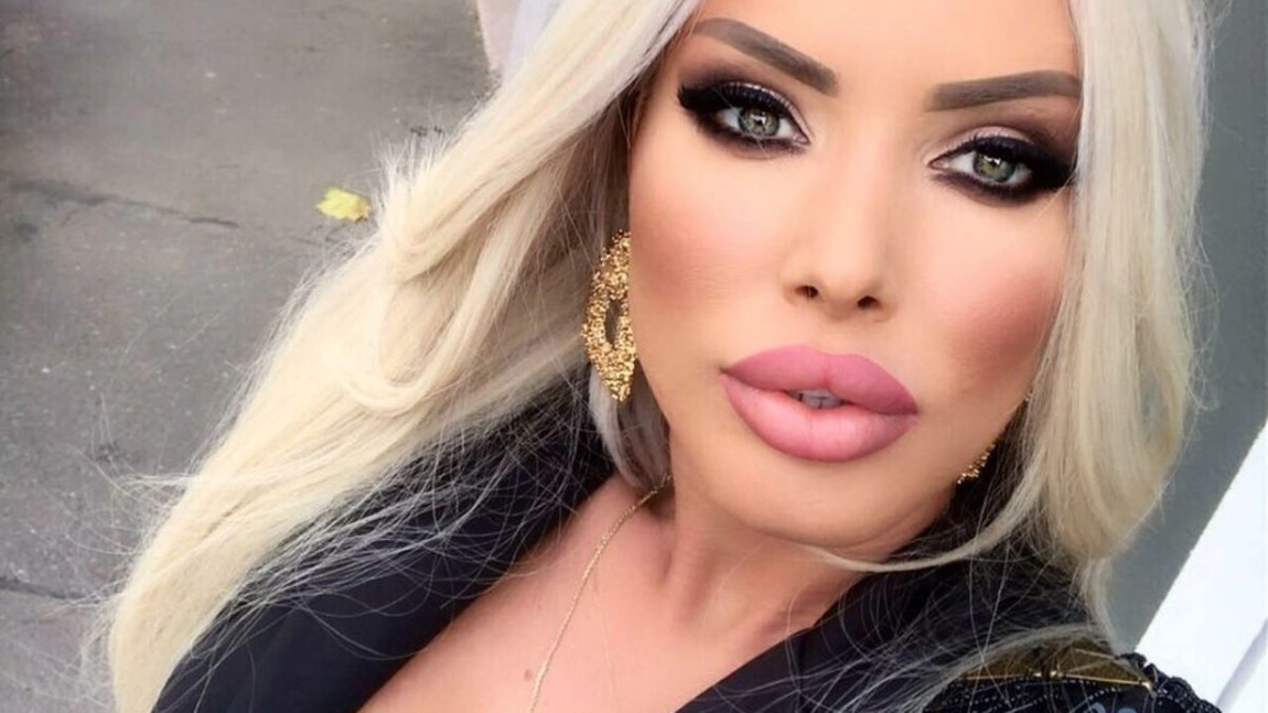 Loredana Chivu a ajuns din nou pe mâna medicilor. Și-a făcut fosta prezentatoare o nouă operație estetică?