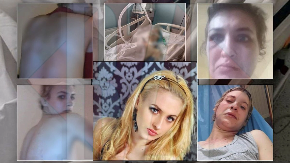 Marfă pentru procurori! Uitați-vă în ce hal este bătută Alina Alexandru, tânăra care s-a stins acum câteva zile la Iași! Imagini cu puternic impact emoțional