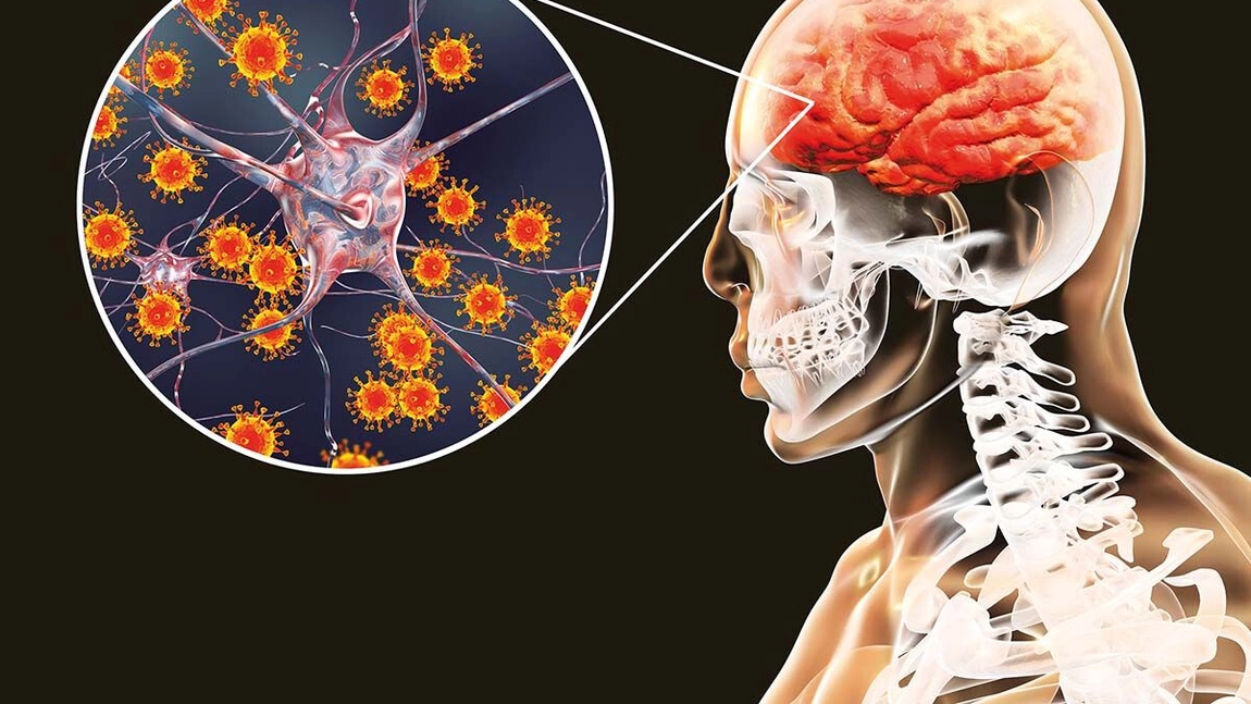 Encefalita japoneză, un nou virus care se răspândește în Australia