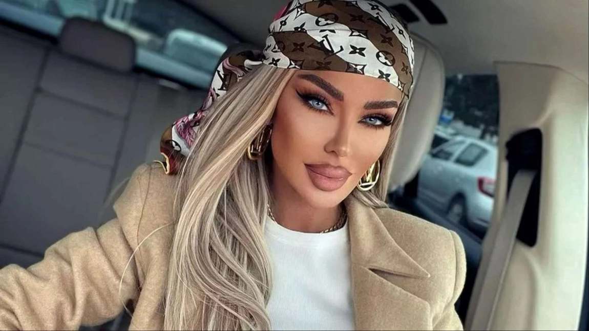 Bianca Drăgușanu a apelat la o nouă intervenție estetică. Ce și-a făcut vedeta la mâini