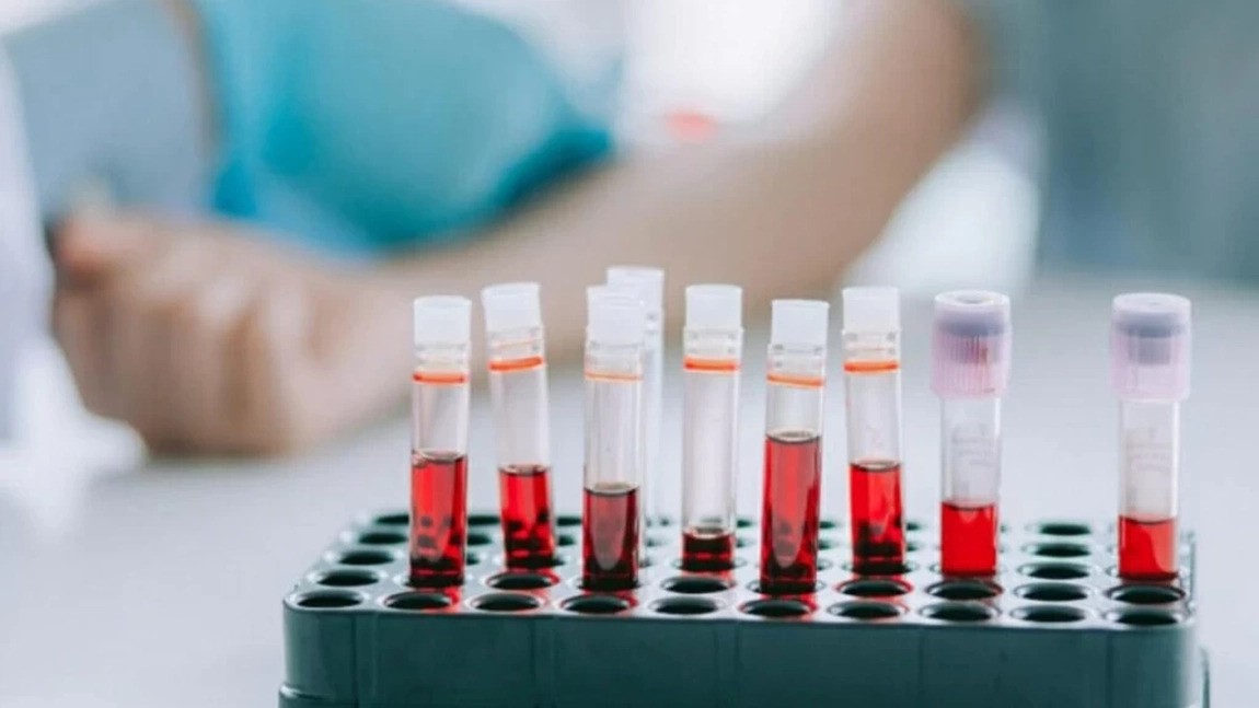 Medicamente care cresc trombocitele. Terapie recomandată de specialiști