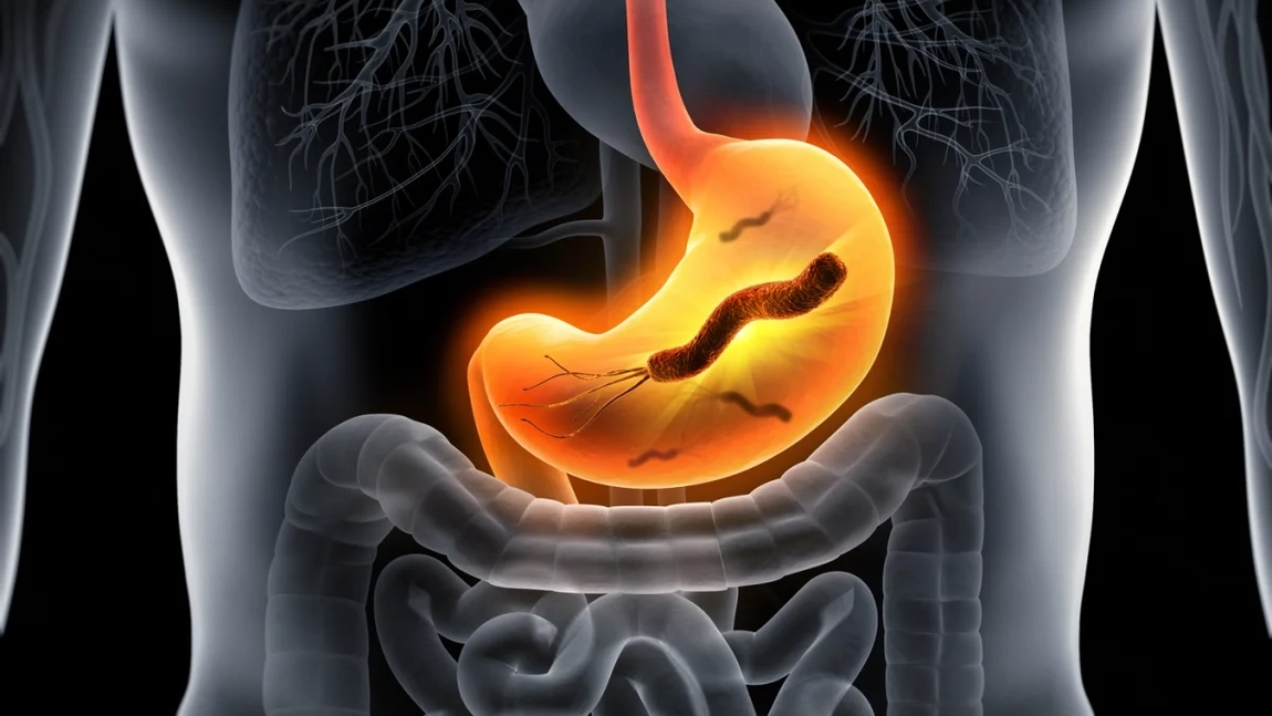 Cum am scăpat de E coli. Tratament medicamentos pentru a uita definitiv de bacterii intestinale