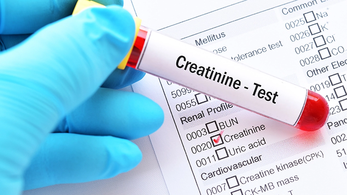 Creatinina mare cauze. Afecțiuni care perturbă funcționarea rinichilor și a mușchilor scheletici