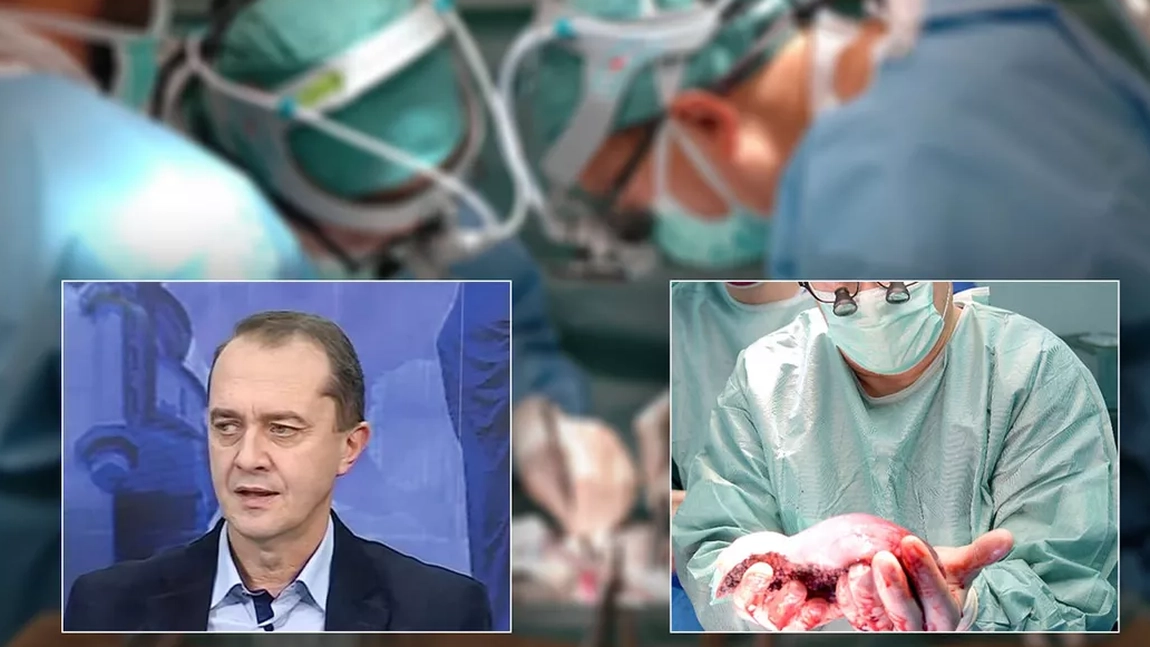 Medicii s-au luptat pentru a salva viața unui pacient de 30 de ani care avea ciroză hepatică. Acesta a primit transplantul de ficat - EXCLUSIV