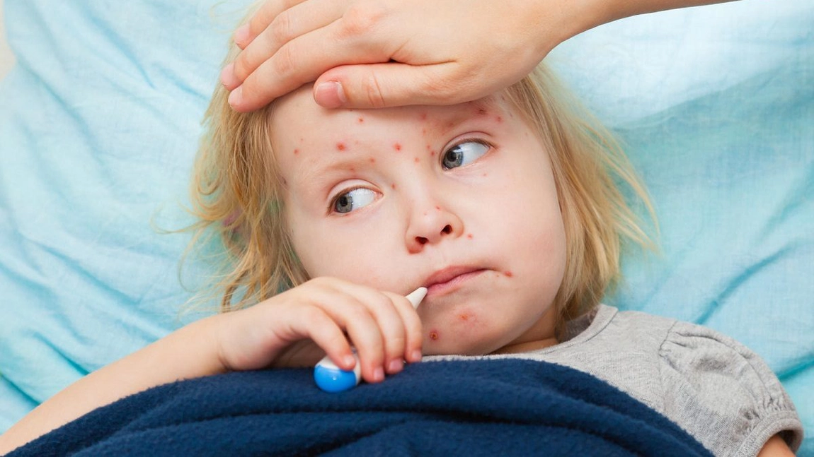 Rujeola face ravagii într-o țară. Aproape 685 de decese, după ce sectele religioase care nu cred în vaccinare au cerut adepților să nu se vaccineze