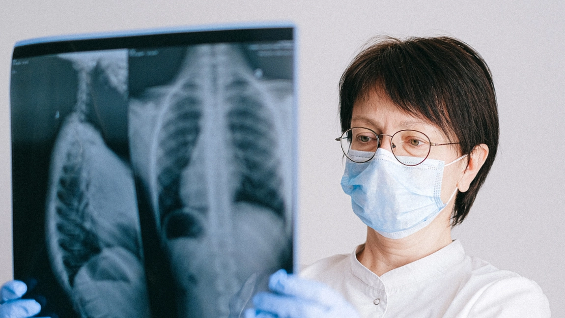 În cât timp se vindecă pneumonia interstitială? Medicamente prescrise de medici pentru a ameliora rapid simptomele
