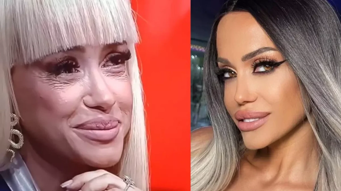 Anda Adam, sfaturi de aur de la specialist, după ce a apărut în emisiunea lui Denise Rifai cu tenul diferit de cel afișat în social media
