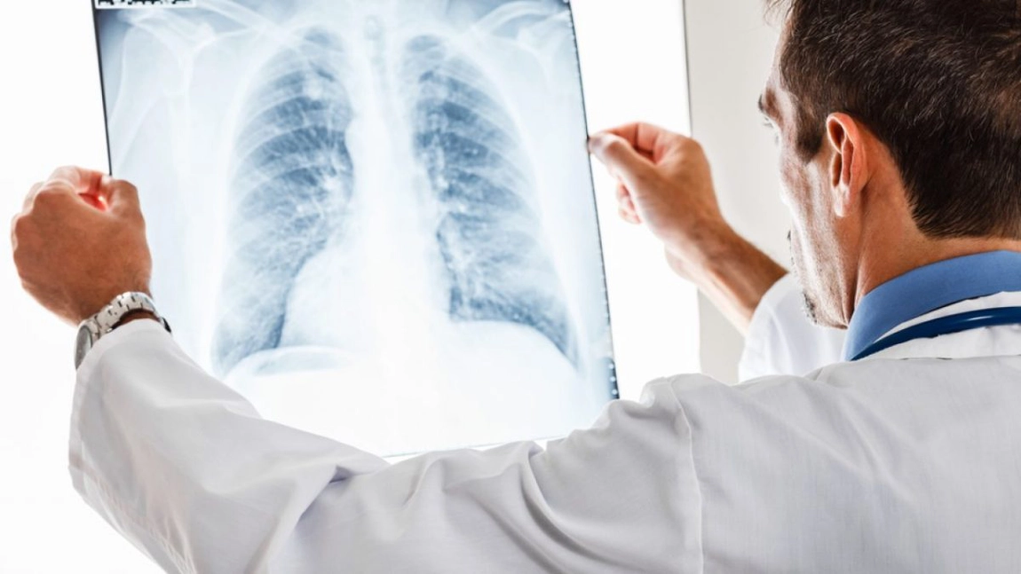 Emfizem subcutanat. Cât de afectate sunt organele respiratorii în timpul bolii?